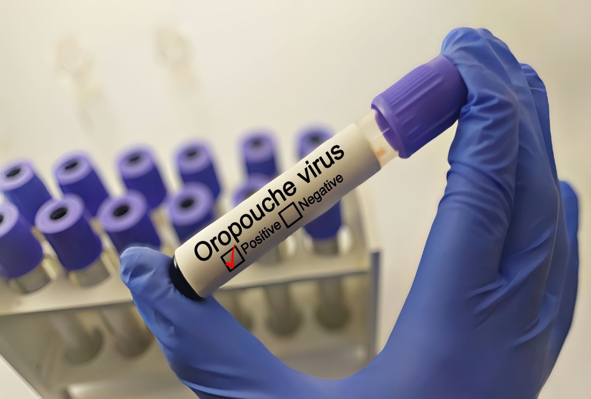 Doctor with Oropouche virus positive blood sample.  (Fania Witardiana / Getty Images)