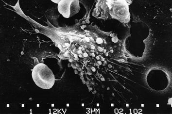Cancer Cell