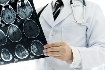 Doctor Brain MRI
