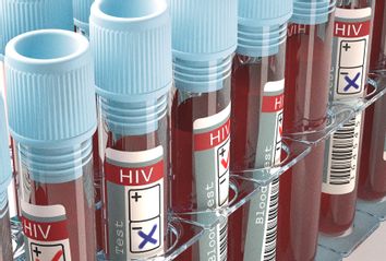 HIV Blood Test