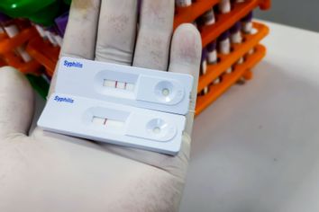 Syphilis rapid test results