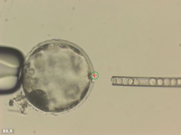 Pig Human Embryos