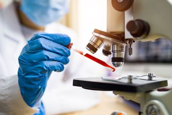 Scientist looking at blood sample