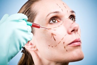 Image for Vampire facelifts: Cosmetic surgery's crazy new trend