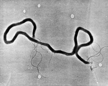 Syphilis Outbreak-Things To Know