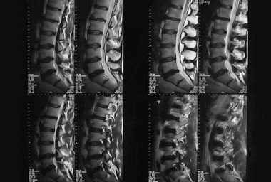 MRI  image of lower back...Vertebral column