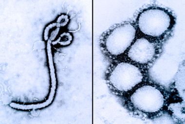 Ebola Virus; Coronavirus