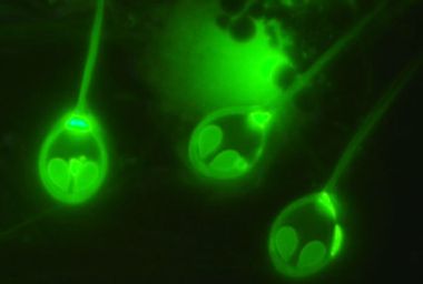 Henneguya salminicola