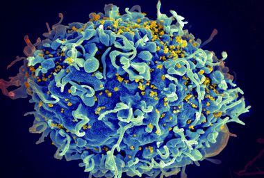 HIV Virus infecting human h9 T cell