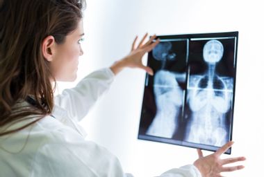 Doctor examining scan