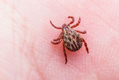 Tick on skin