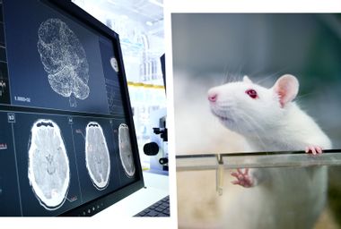 Human brain scan; Laboratory rat