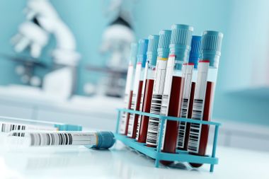 Blood samples and test results in a clinical medical laboratory