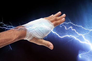 Bandaged Hand and Electricity