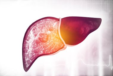 Image for Rapid weight loss may improve advanced fatty liver disease — new research