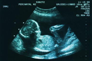 Image for Fetal pain is a lie: How phony science took over the abortion debate