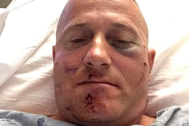 Image for West Virginia state senate candidate brutally beaten with brass knuckles at campaign event