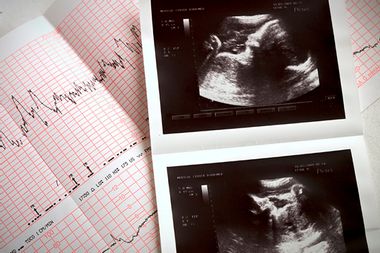 Image for I'm grateful for my abortion