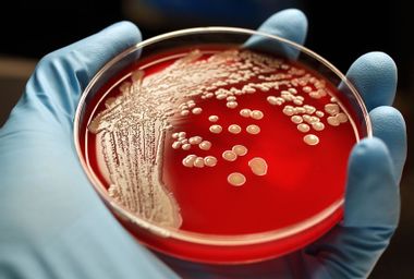 MRSA super bug colonies on blood agar plate