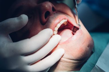 Dentist carrying out dental procedure on patient