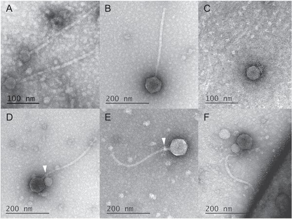 Representative TEM images of isolated phages